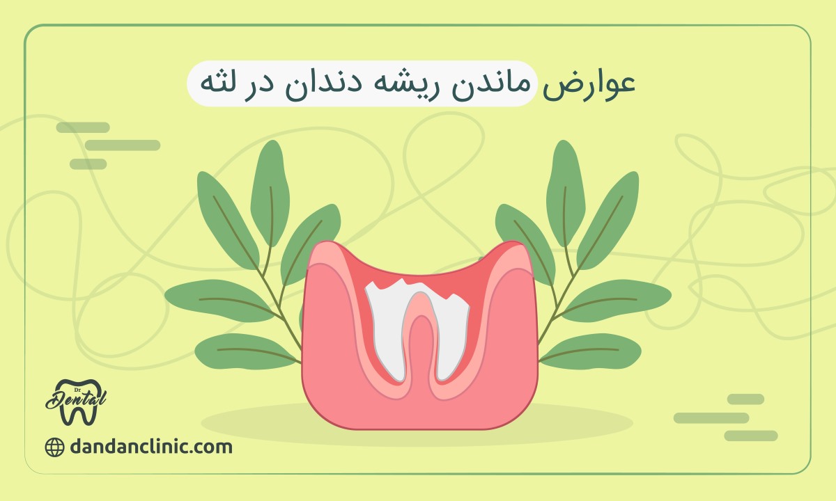 عوارض ماندن ریشه دندان در لثه 