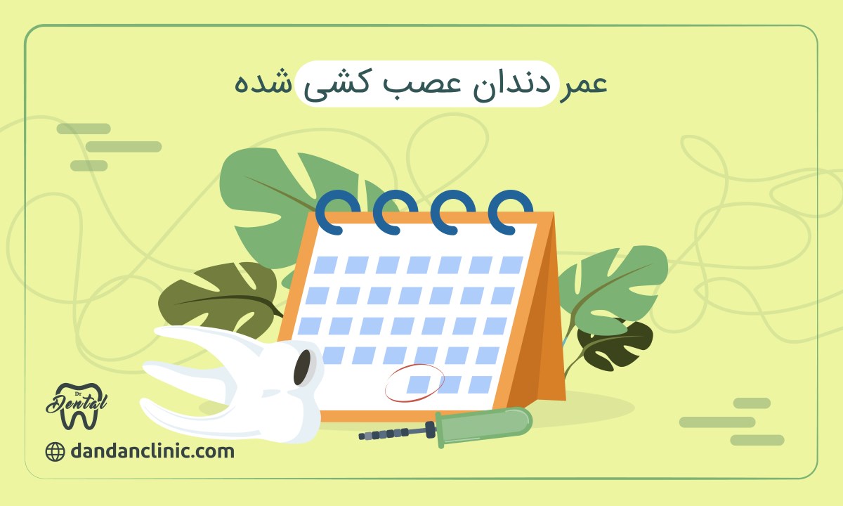 عمر دندان عصب کشی شده 