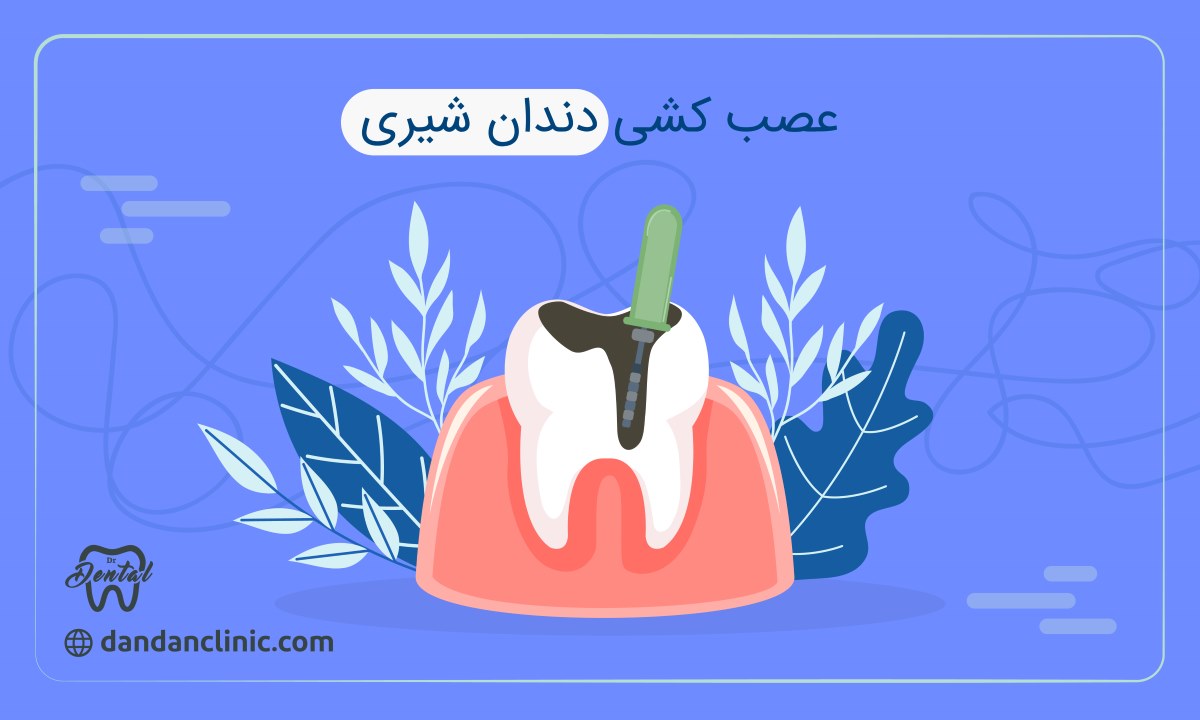 عصب کشی دندان شیری 