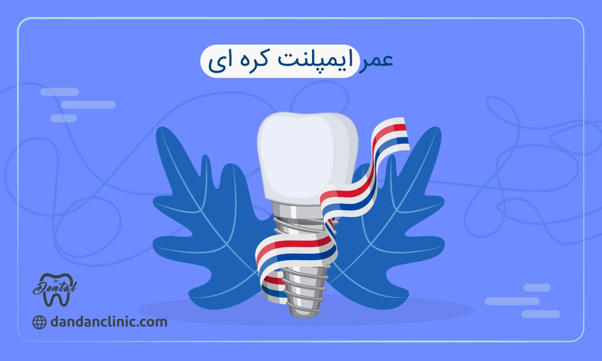 عمر ایمپلنت کره ای 