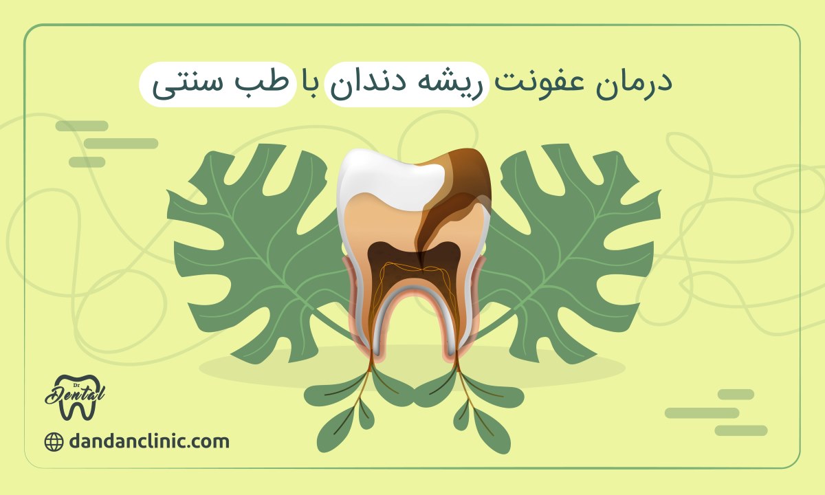درمان عفونت ریشه دندان با طب سنتی
