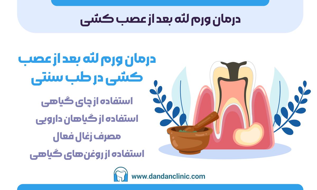 درمان ورم لثه بعد از عصب کشی