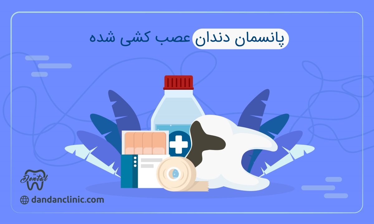 پانسمان دندان عصب کشی شد